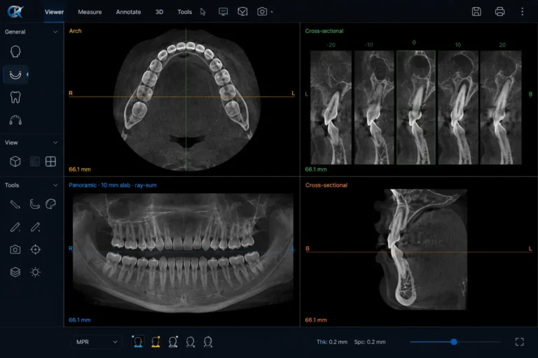 arch and cross sectional view