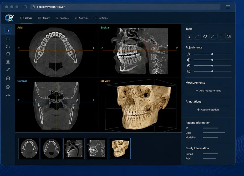 cinray cbct software hero image